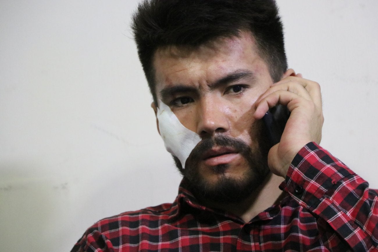 Photo of Afghan journalist with short black hair holding a phone to his ear. One side of his face has a large white bandage on it.